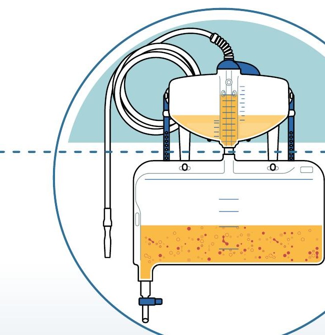 Bacterial migration illustration